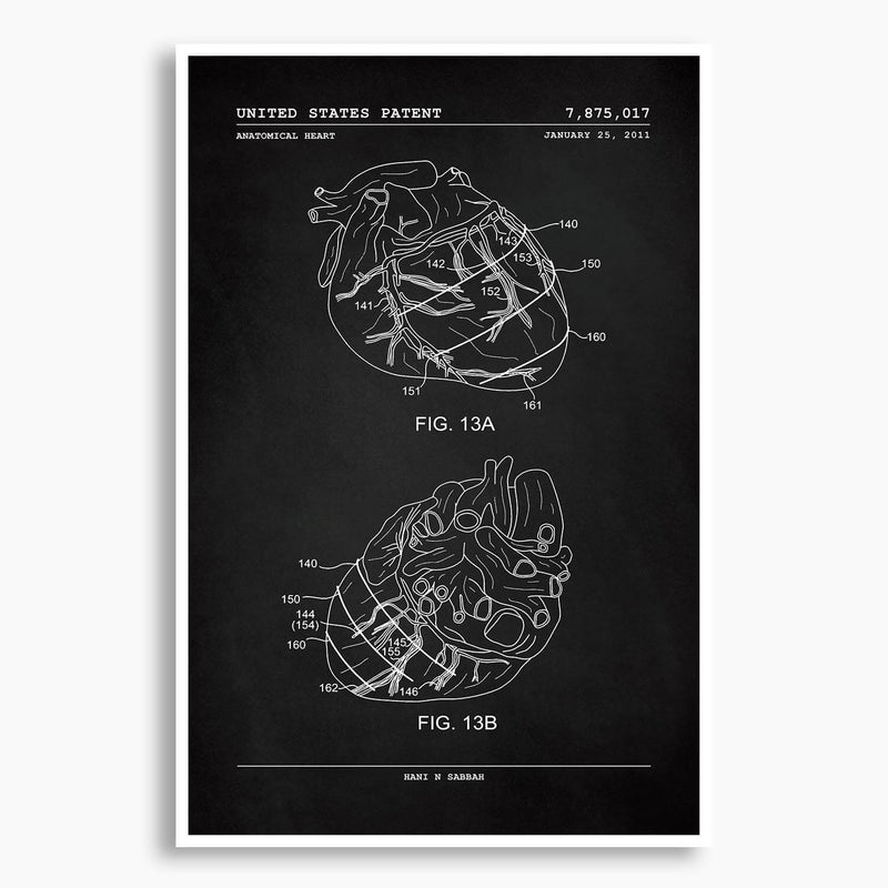 Anatomical Heart Patent Poster; Patent Artwork, Antique Parchment